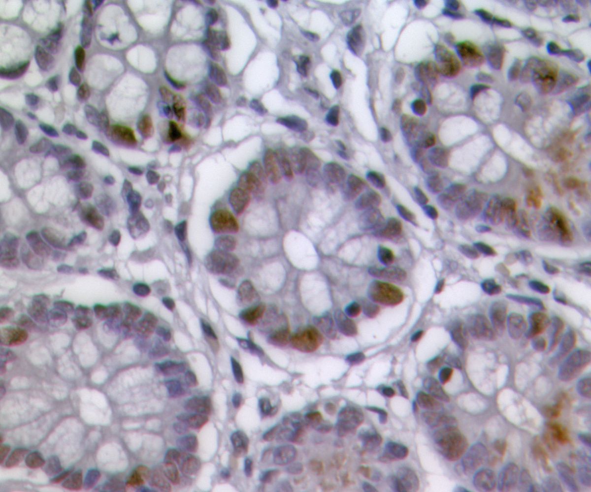 Fundamental Discovery