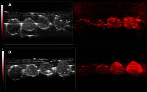 Nanoparticle