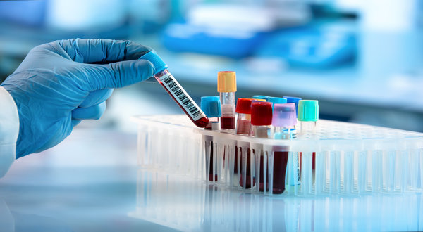 University start-up commences clinical trial for the treatment of ARDS in COVID-19 patients