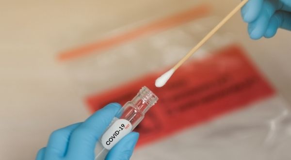 Researchers from University of Galway and the University of Wyoming have received funding to develop a rapid COVID-19 test.