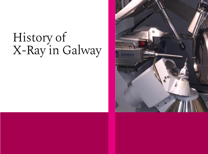 History of X-Ray in Galway 